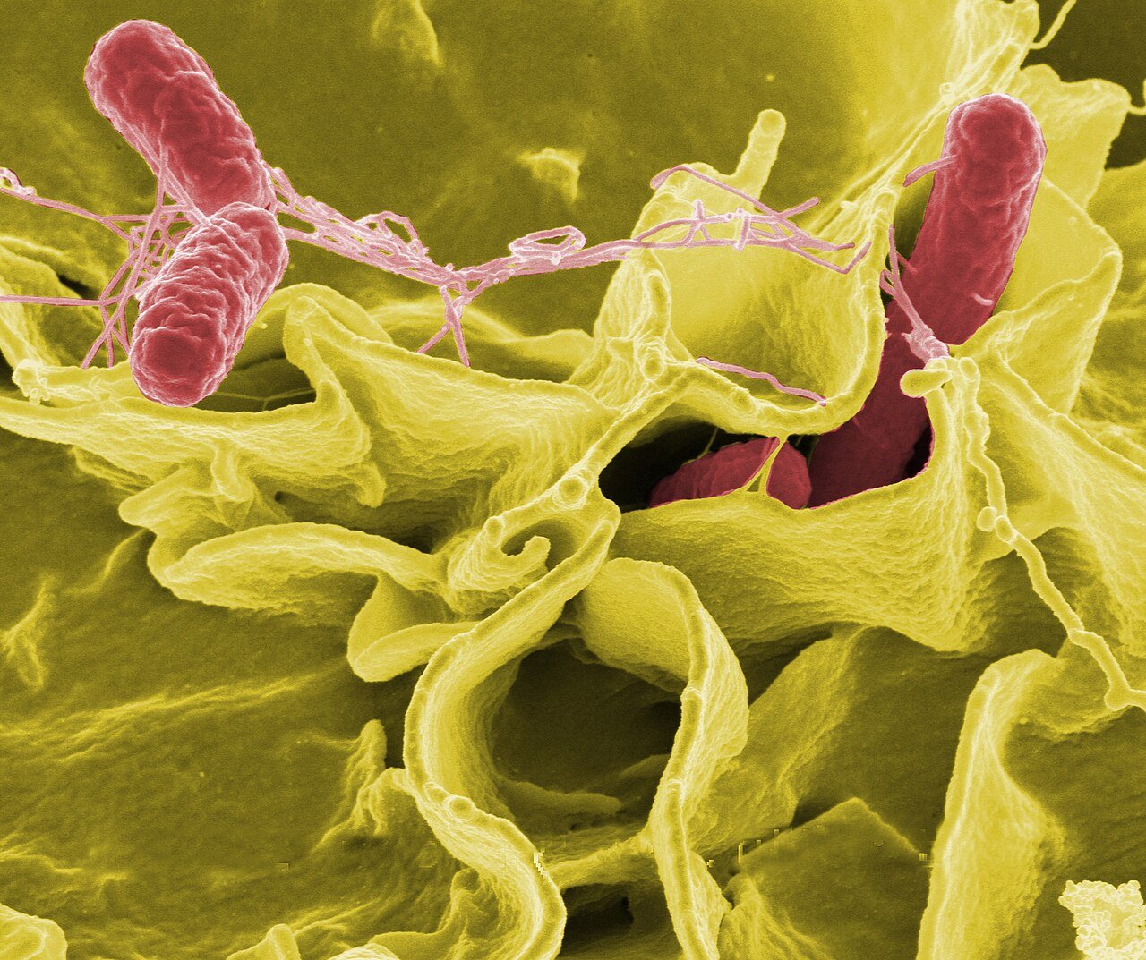 Salmonella bacteria, hugely magnified and colour-enhanced